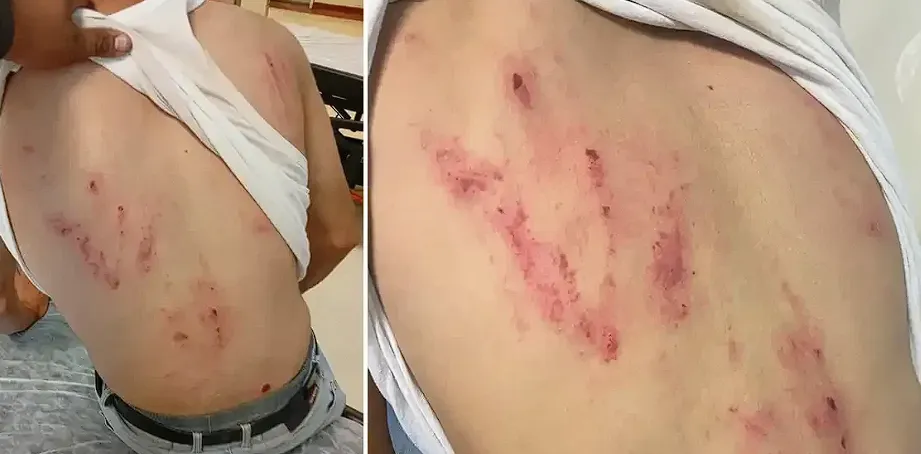 Şanlıurfa’da ŞUSKİ personeline köpekli saldırı!