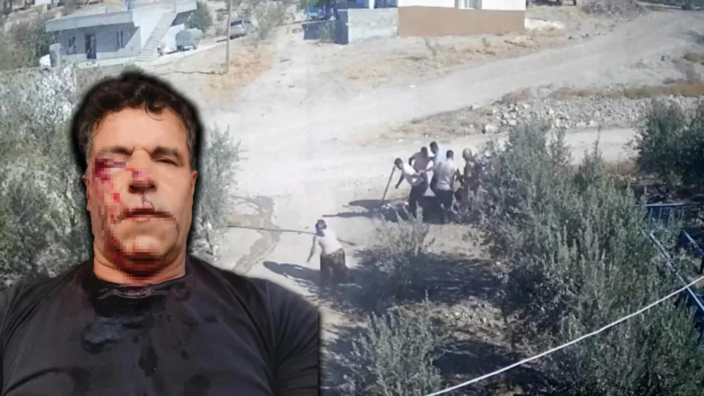 Şanlıurfa’da kan donduran kavga